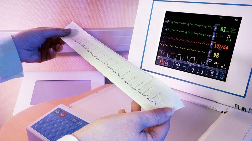 www.ensocure.com-electrocardiogram