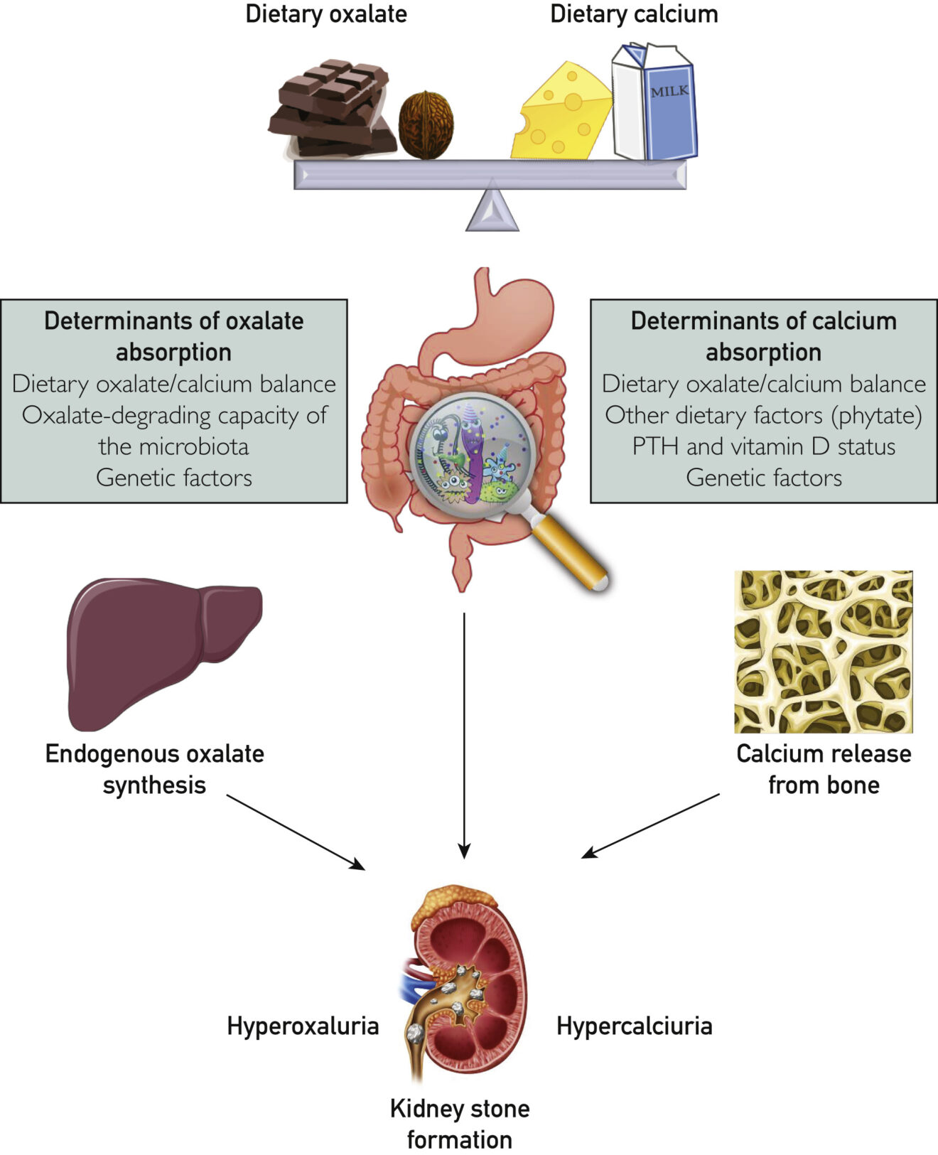 Avoid These 10 Foods Bad for Kidney Stones Ensocure