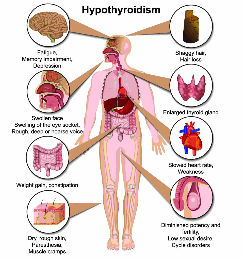 www.enscoure.com-hypothyroidism
